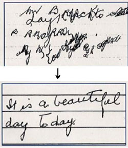 82歳のアルツハイマー病患者の筆跡。アリセプト投与後、大きく改善しているのが分かる。（出典:British Medical Journal / 4 December, 1999）
